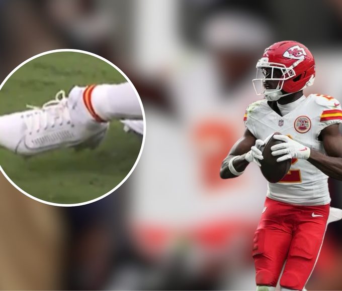 Tyquan Thorton estaba jugando el mejor partido desde su llegada a la NFL, hasta que una aparatosa lesión lo obligó a salir del juego.